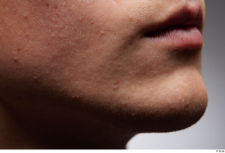 HD Face Skin Urien cheek chin face lips mouth skin…